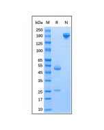 Mouse Anti-Human IgE epsilon chain Antibody