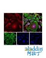 Goat Anti-Rabbit IgG H&L (AF594)